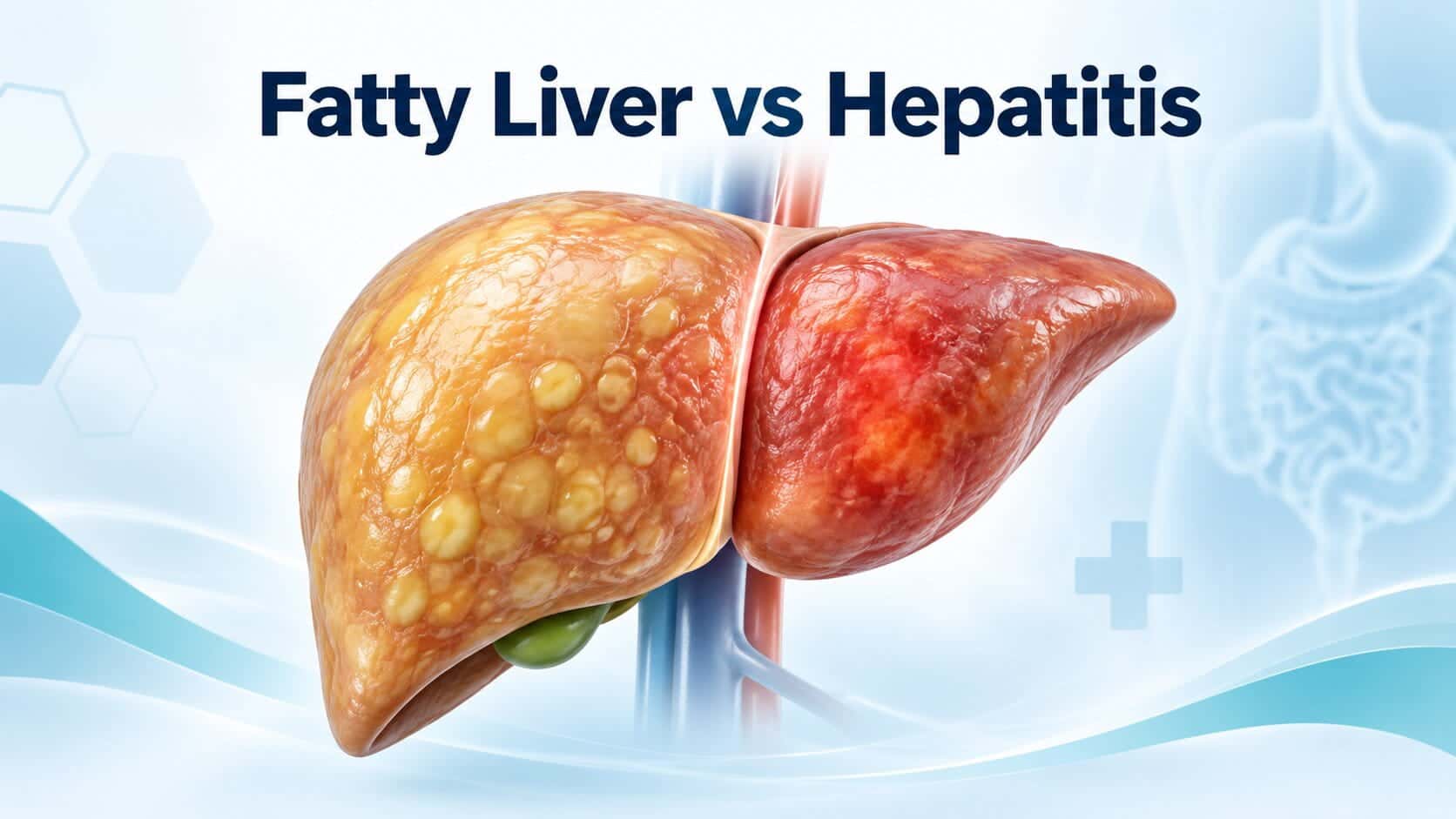 Difference Between Fatty Liver and Hepatitis